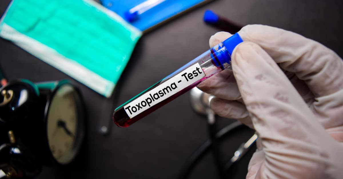 toksoplazma teşhisi nasıl yapılır?